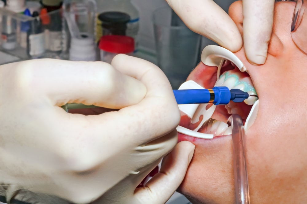 Dentist performing teeth whitening treatment