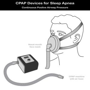 Continuous positive air pressure (CPAP) machine